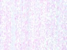 SSS Braid thumbnail